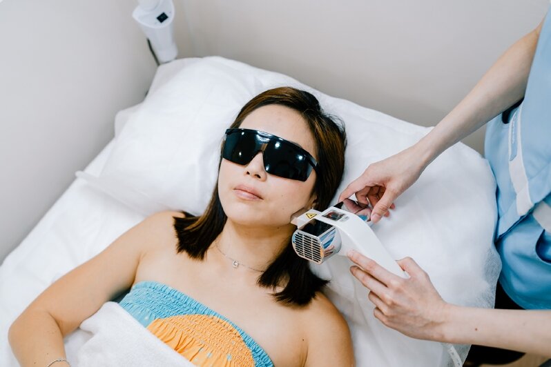 Girl getting IPL on her chin